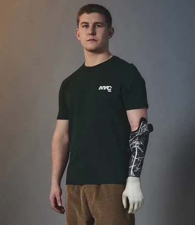 Man wears dark green t shirt and prosthetic arm